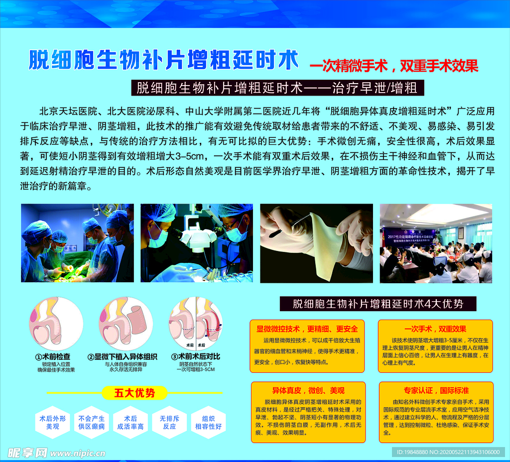 生物补片