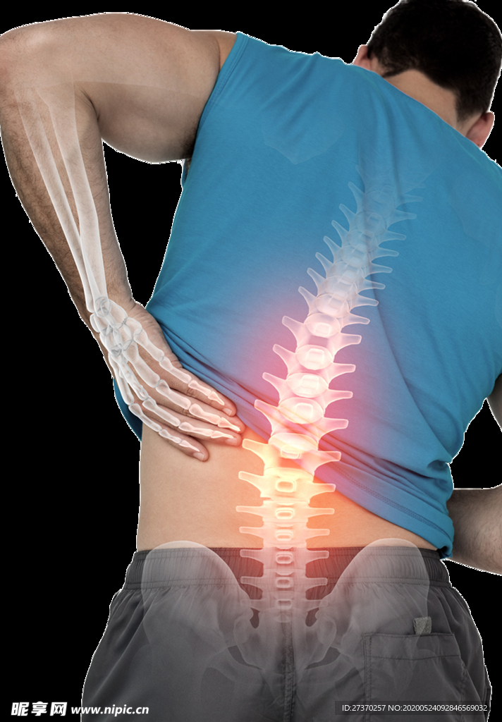 腰椎病图片