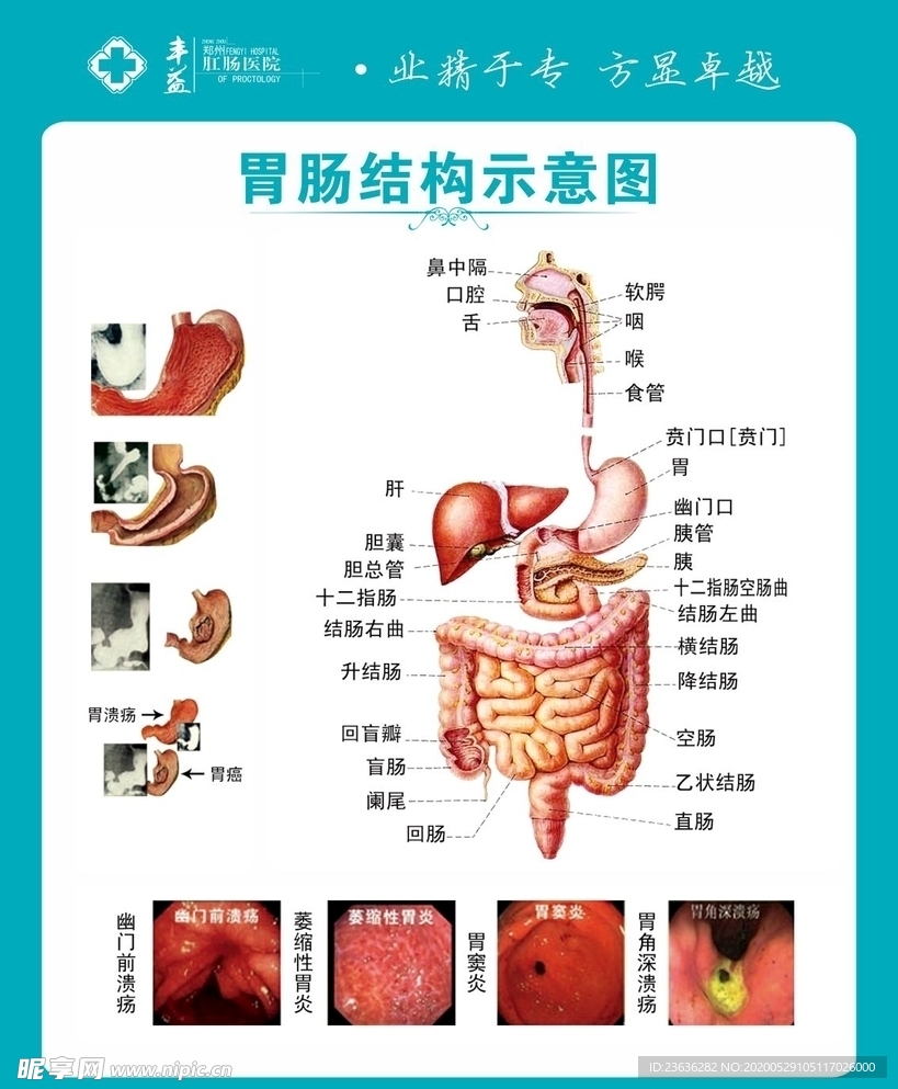 胃肠结构示意图