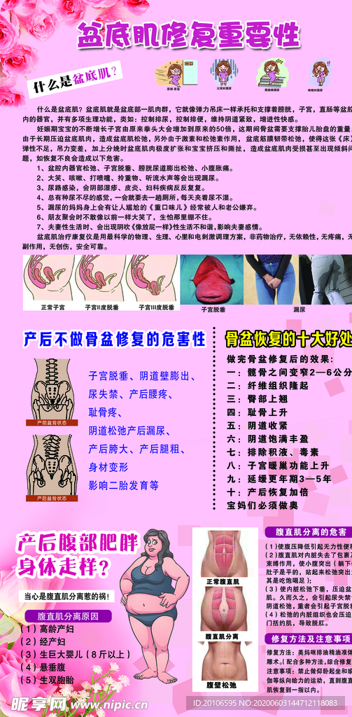产后修复