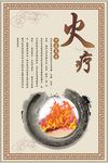 火疗