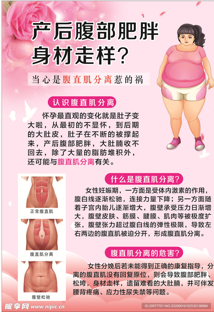 腹直肌分离