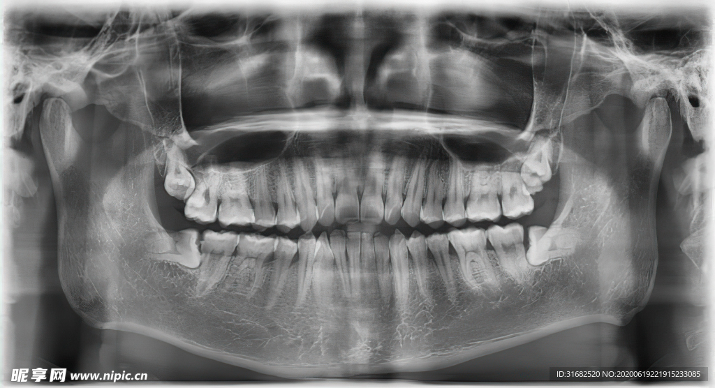 牙科X线全景四智齿两多生牙