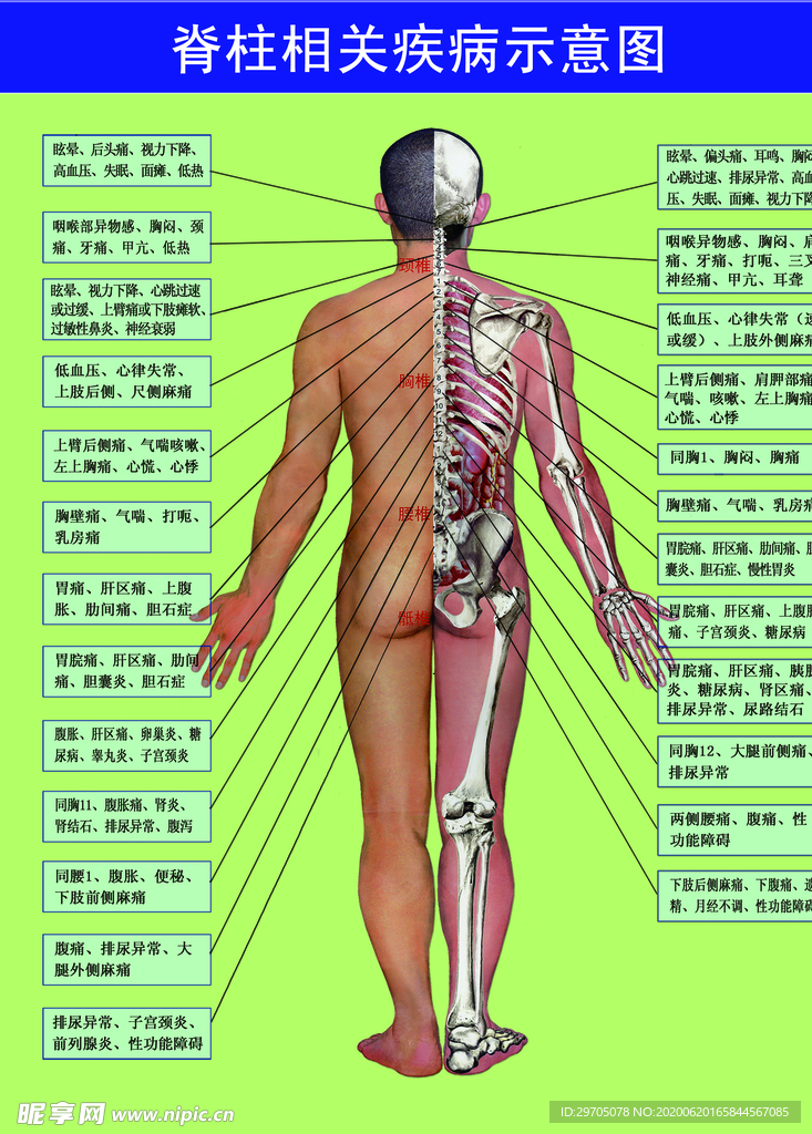 脊柱相关疾病示意图