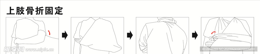 上肢骨折固定手绘步骤
