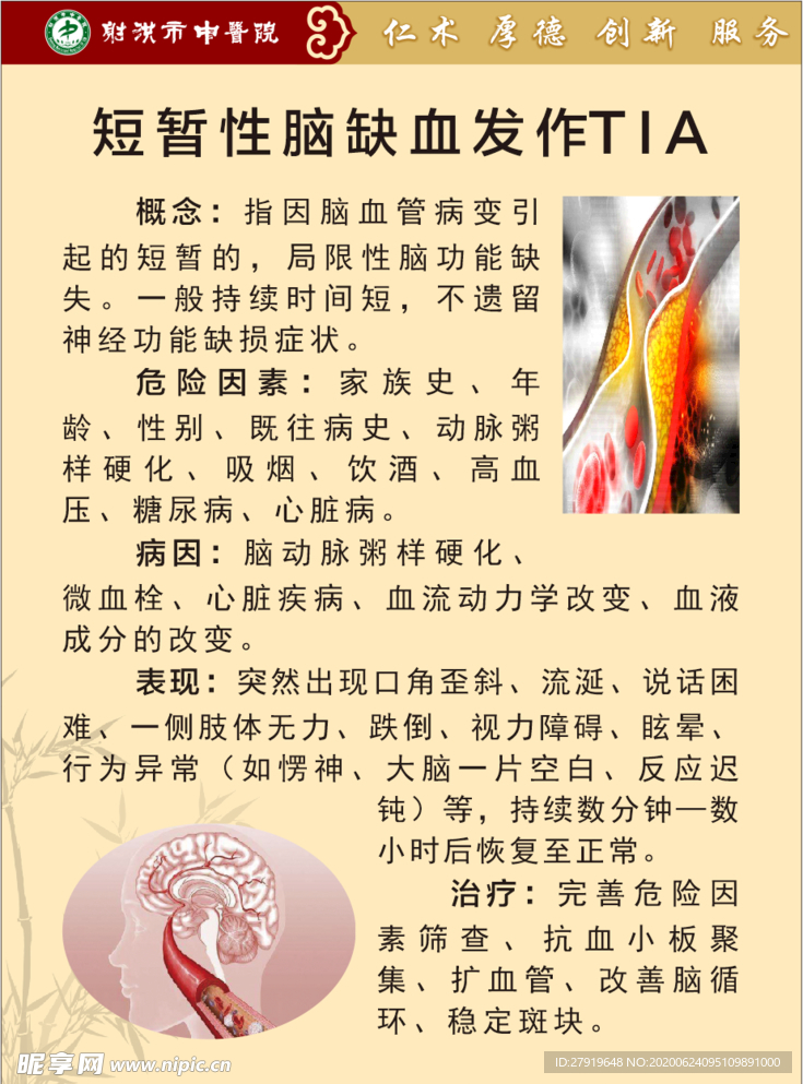 短暂性脑缺血发作TIA
