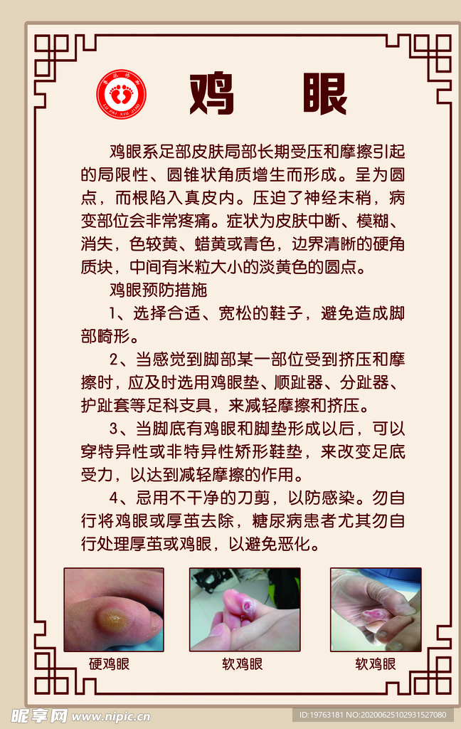 鸡眼