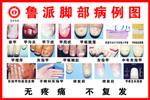脚部病例图