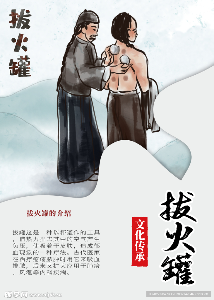 拔火罐