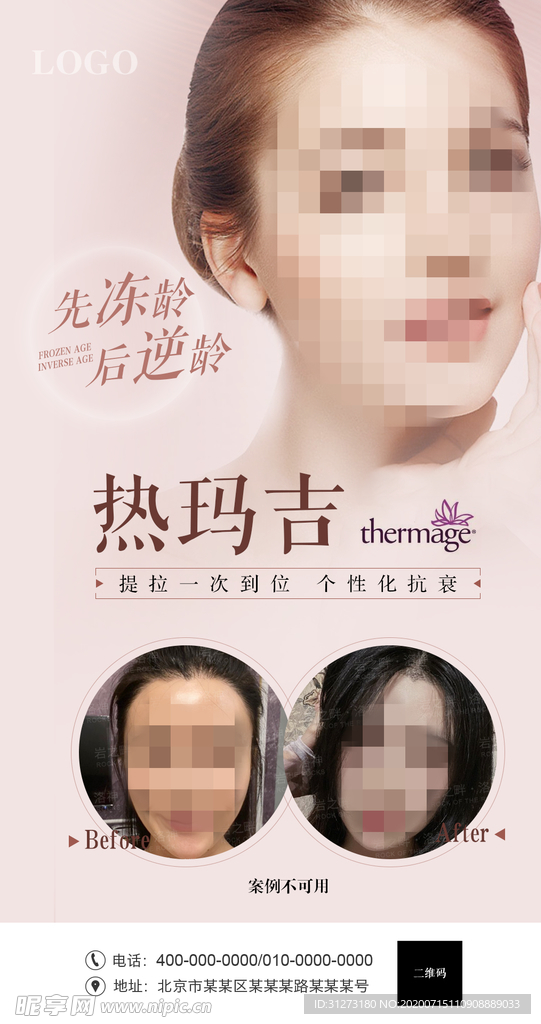 热玛吉