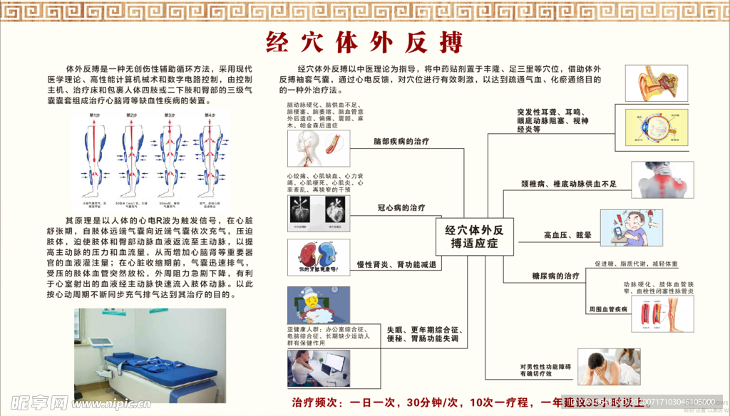 经穴体外反搏