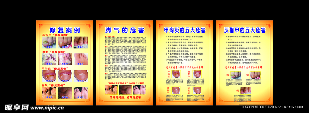 灰指甲