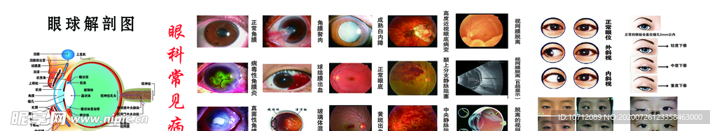 常见眼科病