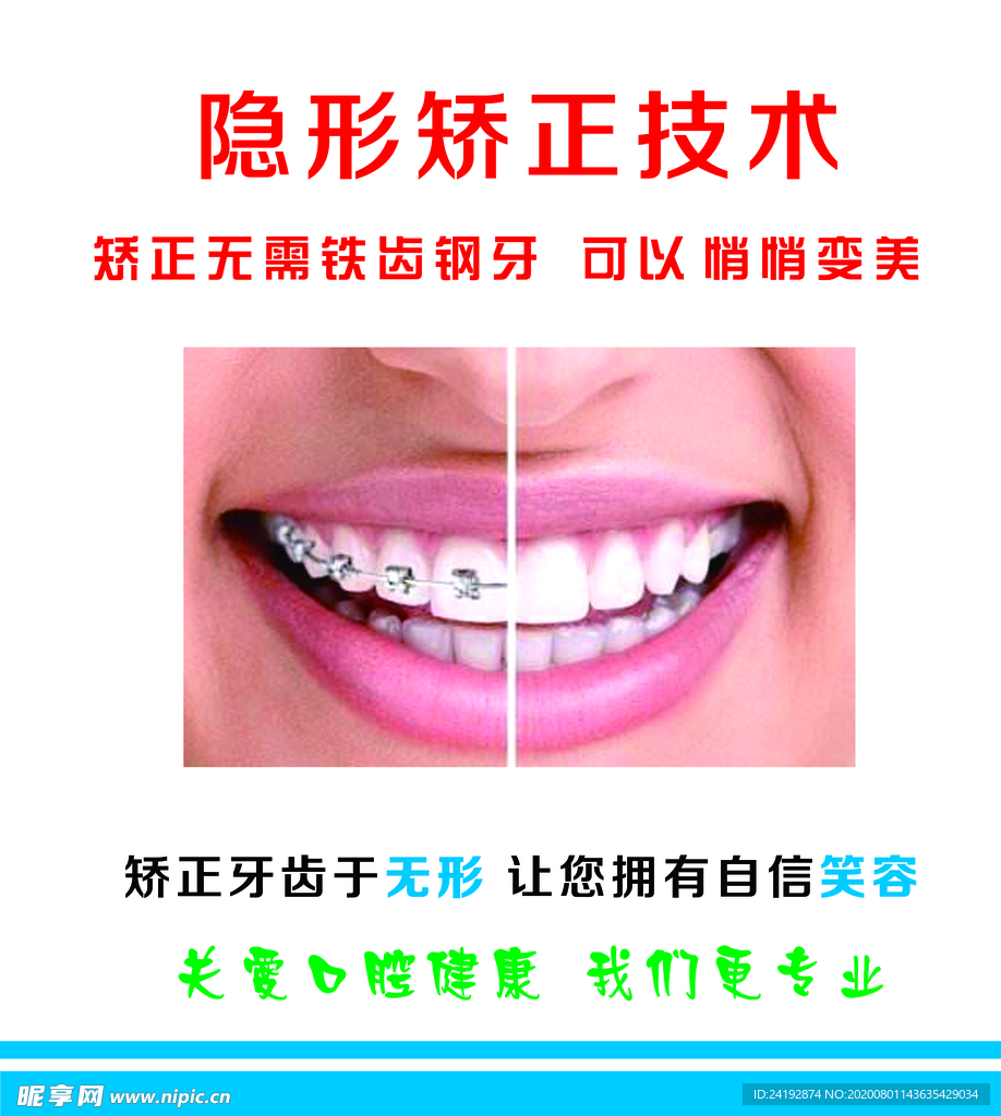 牙齿矫正