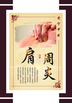 肩周炎