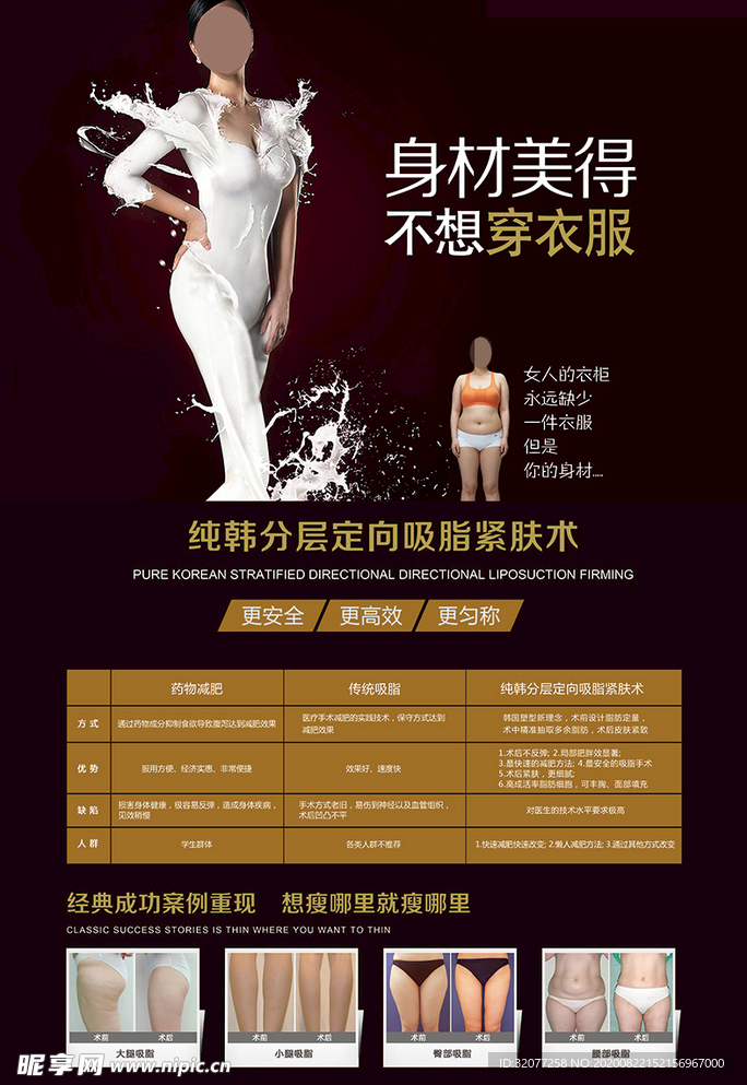 纯韩分层定向吸脂术