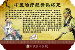 中医治疗股骨头坏死