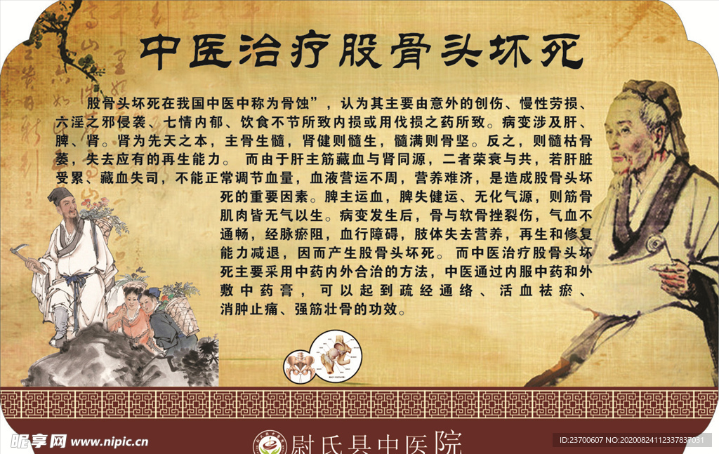 中医治疗股骨头坏死