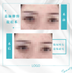 医美对比图