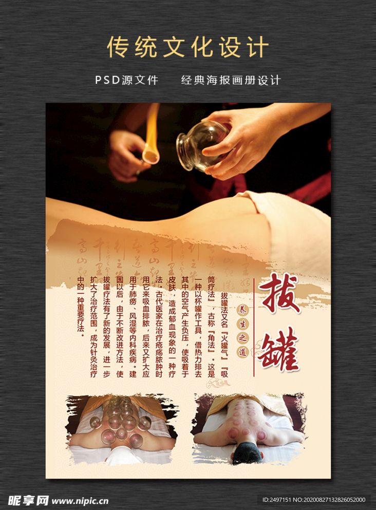 中医传统文化拔罐