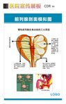 前列腺剖面模拟图