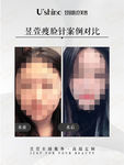 医美整形医院案例对比海报