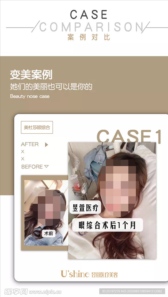 医美整形医院案例对比海报