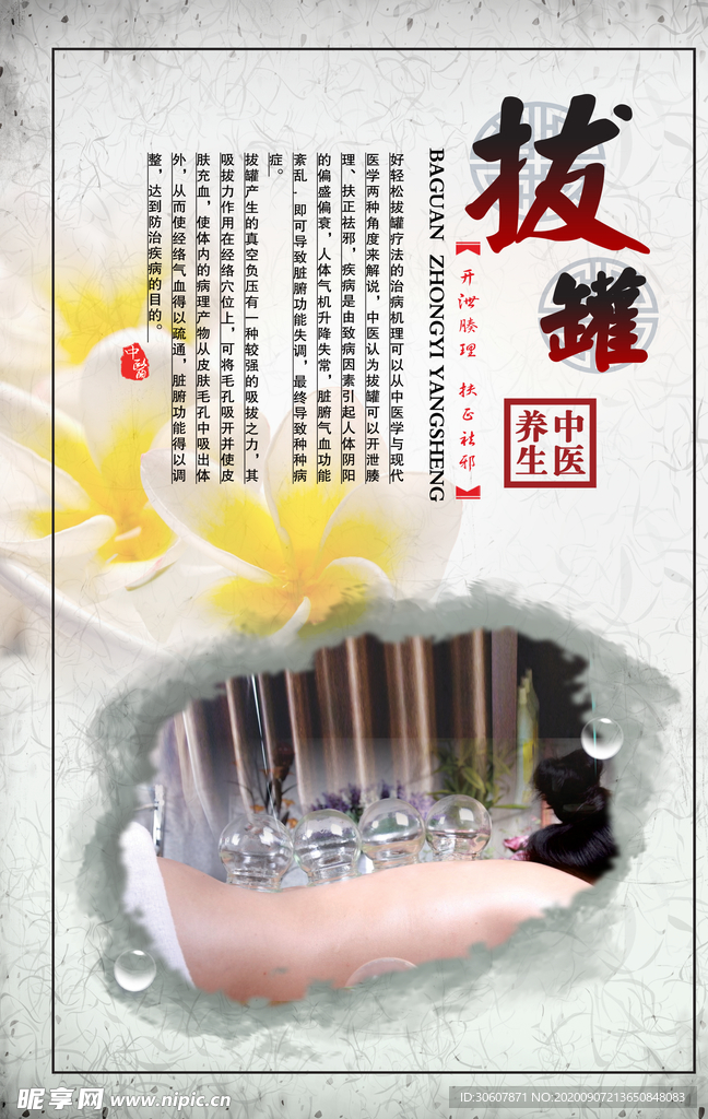 拔罐海报