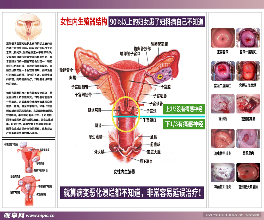 妇科病展板