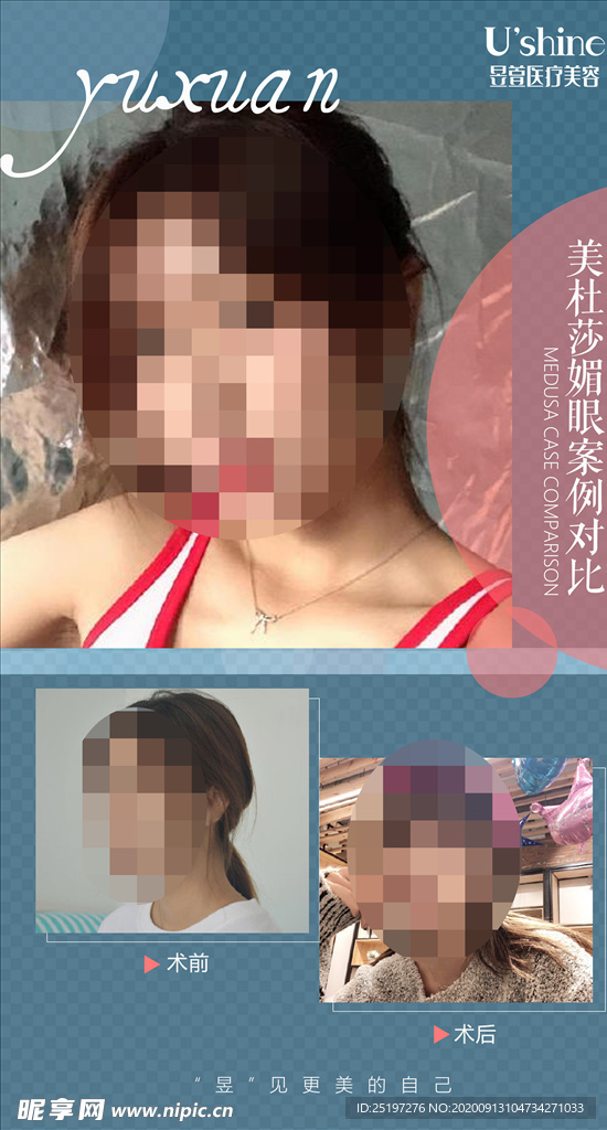 医美整形医院案例对比海报