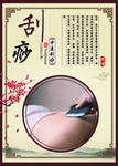 刮痧