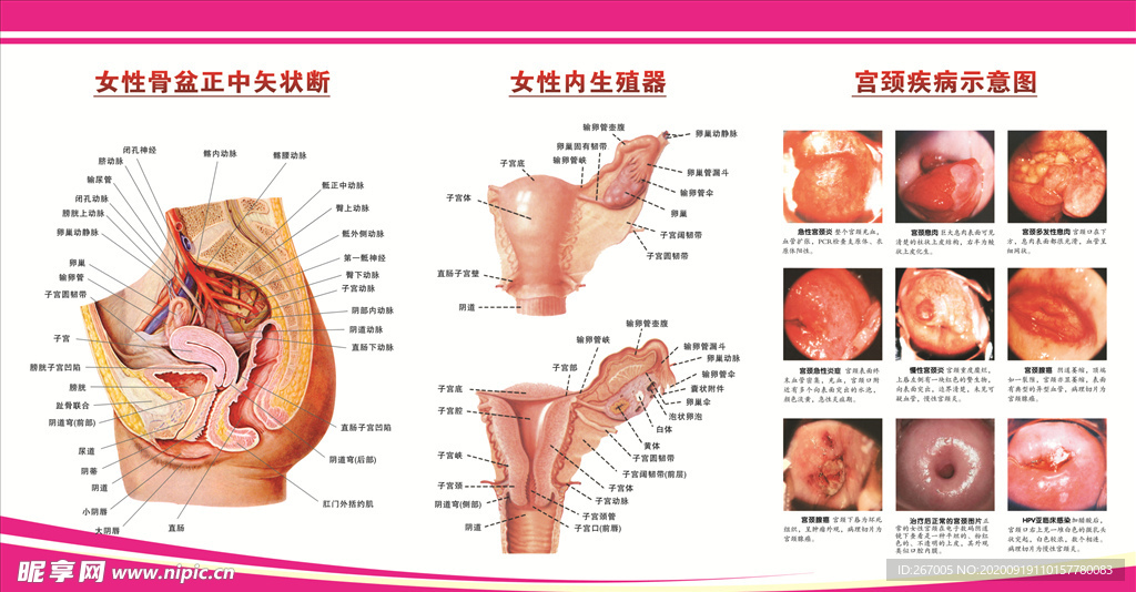 妇科图解