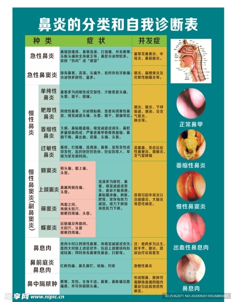 鼻炎的分类和自我诊断表