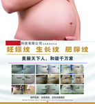 妊娠纹海报
