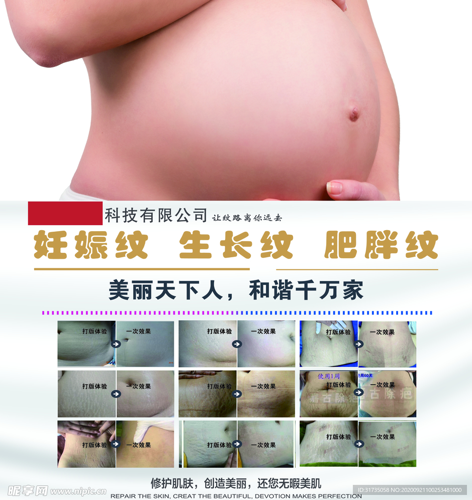 妊娠纹海报