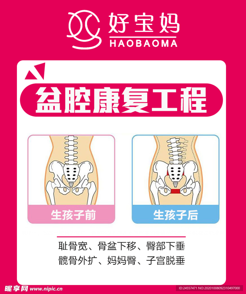 产后修复