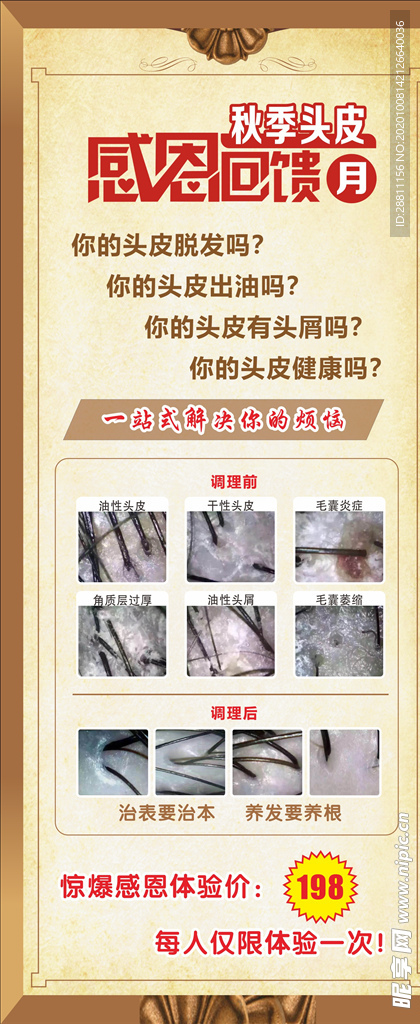 头皮展架