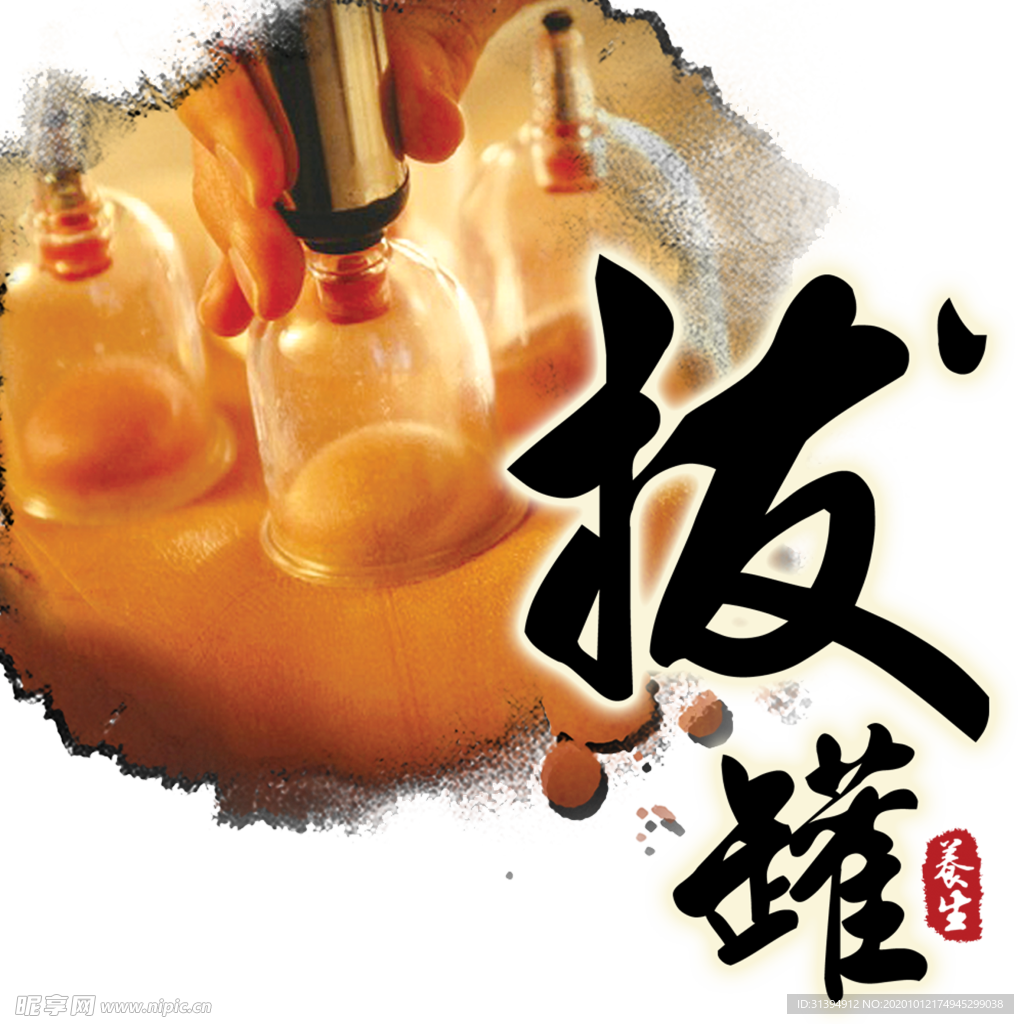 拔罐
