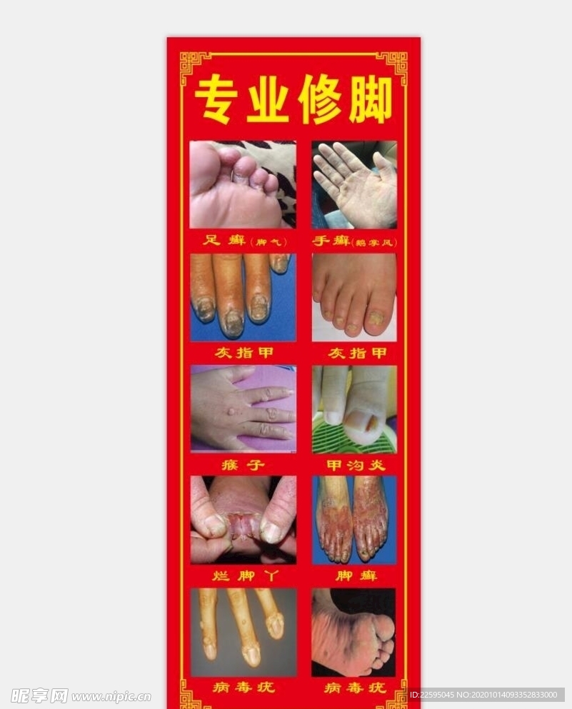 专业修脚 修脚