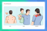 肩周炎常规治疗背景海报素材