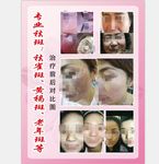 美容海报