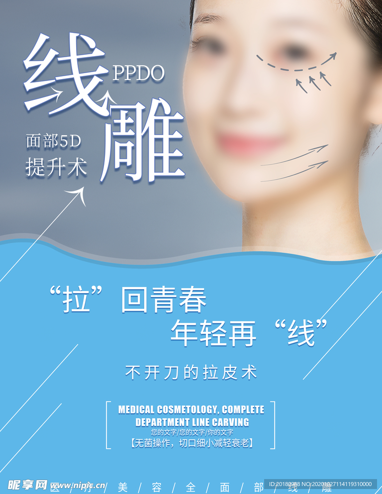 线雕