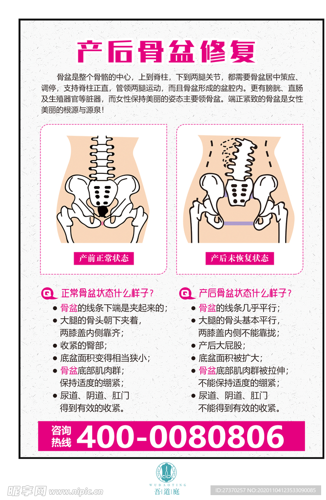 产后骨盆修复