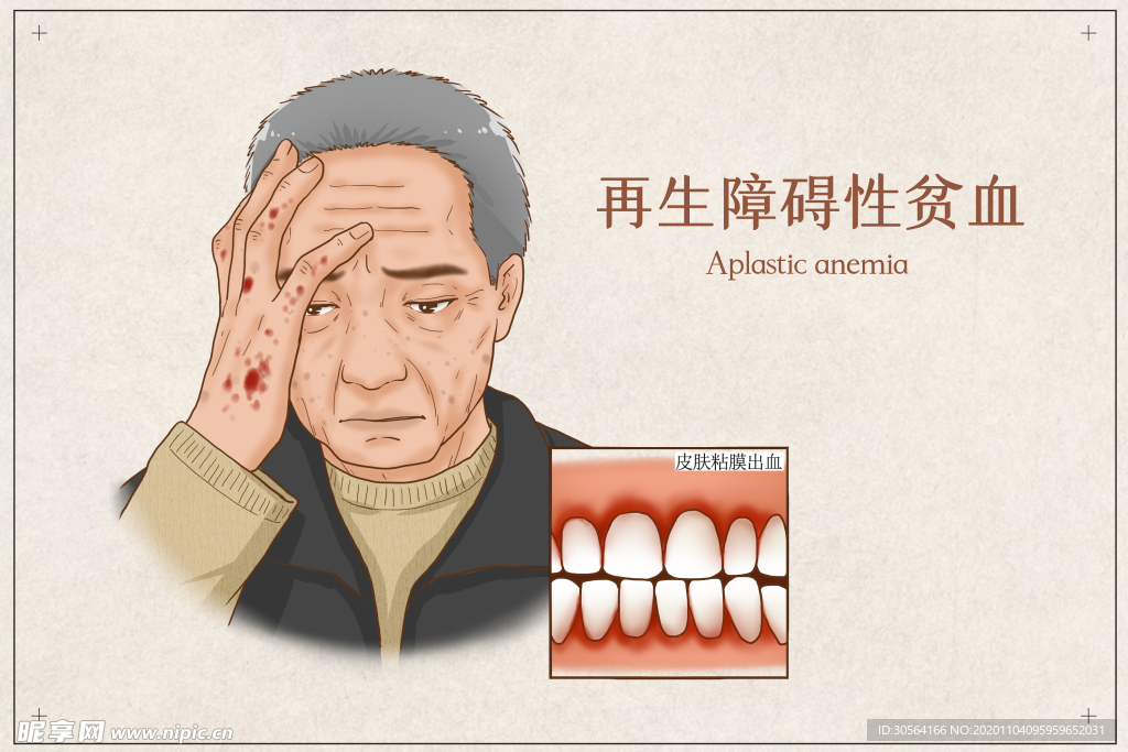 贫血疾病健康卫生背景素材