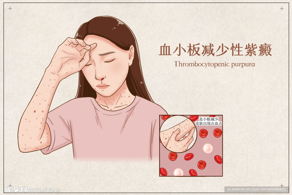 血小板疾病健康卫生背景素材