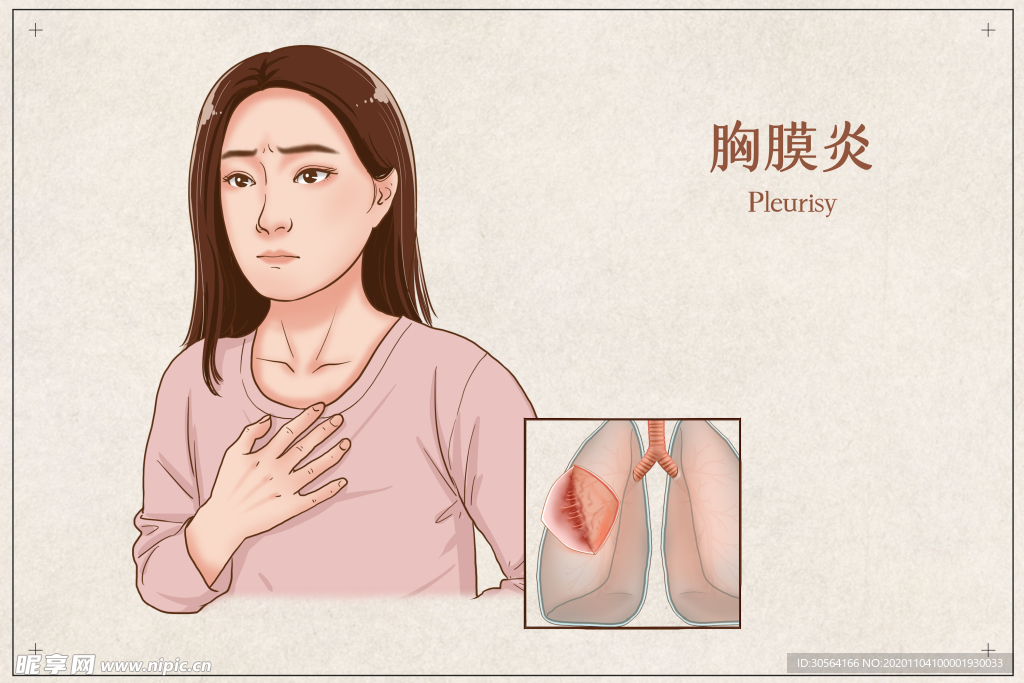 胸膜炎はどのようにして起こるのでしょうか?