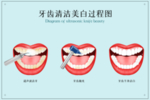 牙齿美白清洁过程效果背景素材