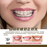 牙齿矫正