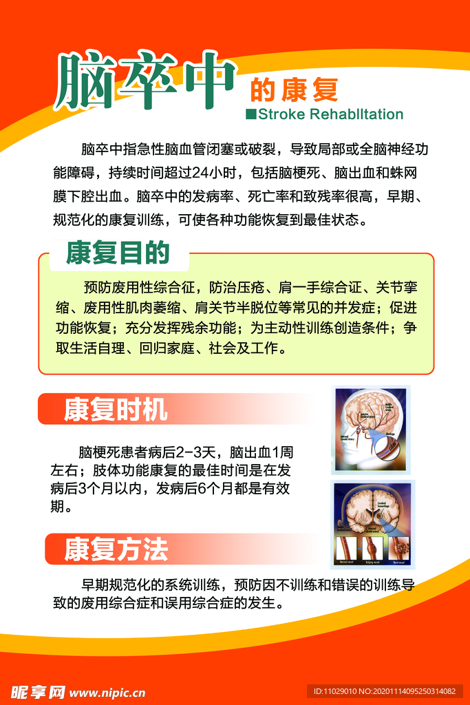 脑卒中