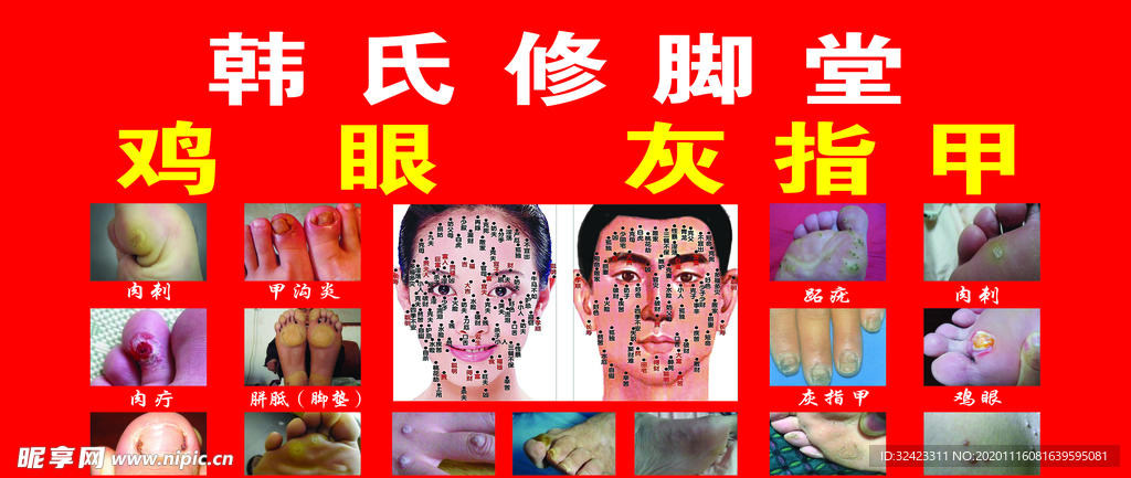 灰指甲